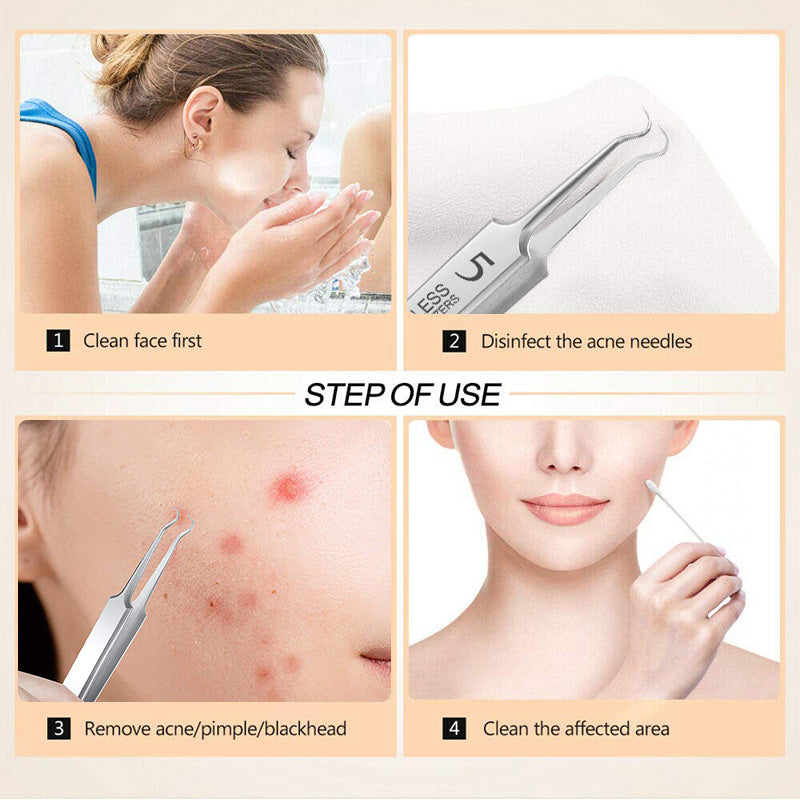 🔥Spezialisierte Pinzetten für Schönheitssalons