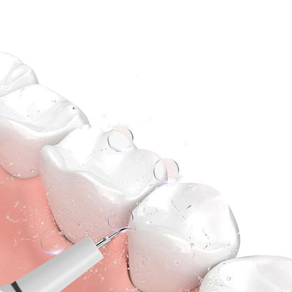 🦷Ultraschall-Munddusche mit Elektrobetrieb✨💙