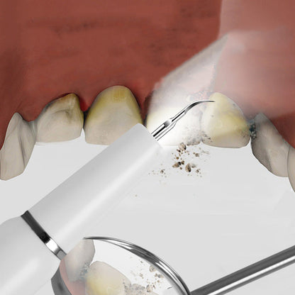 🦷Ultraschall-Munddusche mit Elektrobetrieb✨💙