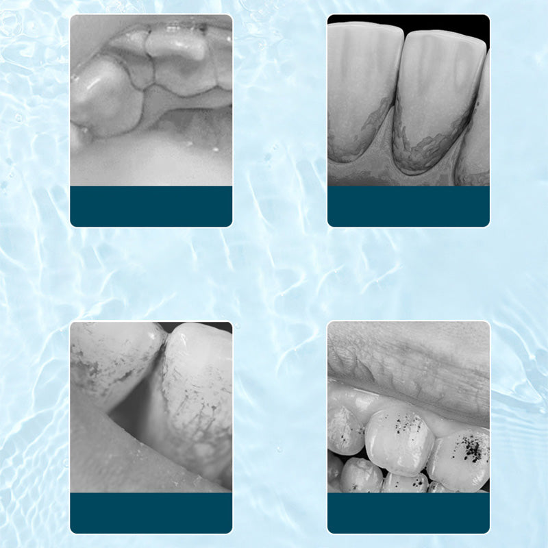 🦷Ultraschall-Munddusche mit Elektrobetrieb✨💙