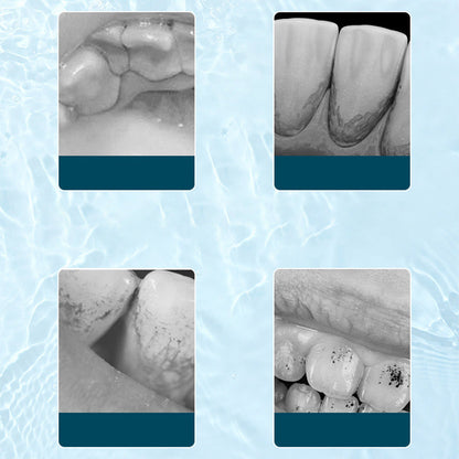 🦷Ultraschall-Munddusche mit Elektrobetrieb✨💙