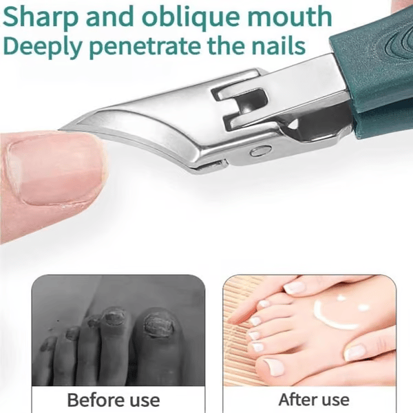 💥Von Podologen empfohlener Nagelknipser – Ergonomisches, abgewinkeltes Design für Zehennägel und eingewachsene Nägel