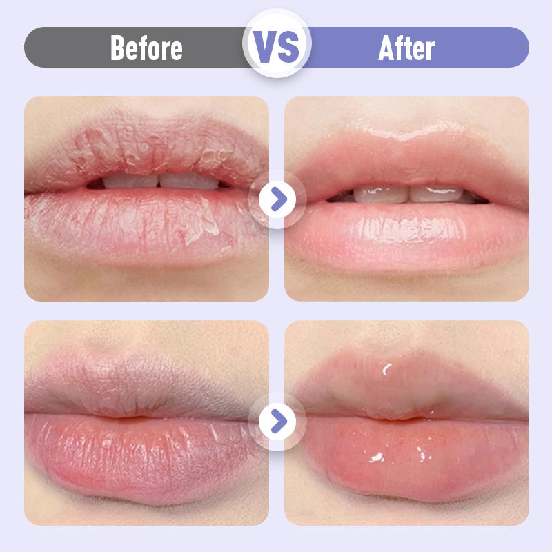 📢📢50 % Rabatt !!Aufpolsterndes und feuchtigkeitsspendendes Lippenserum gegen Falten